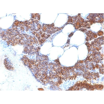 Immunohistochemistry - Anti-Parathyroid Hormone Antibody [PTH/2295R] (A249769) - Antibodies.com