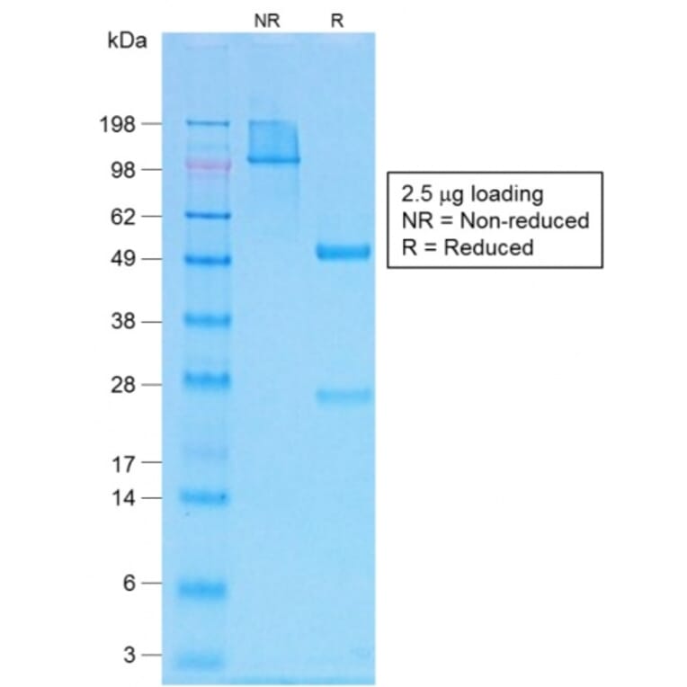 SDS-PAGE - Anti-Parathyroid Hormone Antibody [PTH/1717R] (A249770) - Antibodies.com