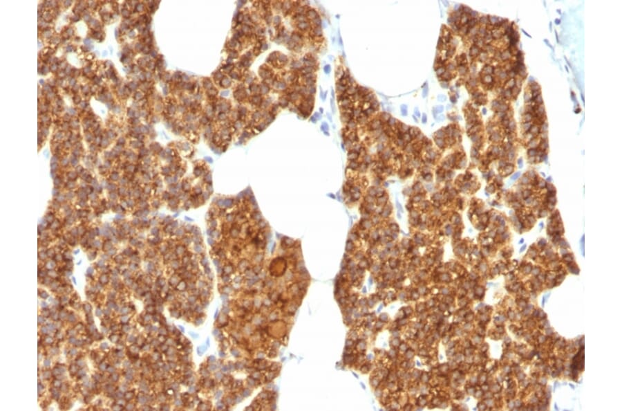 Immunohistochemistry - Anti-Parathyroid Hormone Antibody (A249770) - Antibodies.com