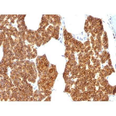 Immunohistochemistry - Anti-Parathyroid Hormone Antibody (A249770) - Antibodies.com