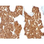 Immunohistochemistry - Anti-Parathyroid Hormone Antibody (A249770) - Antibodies.com
