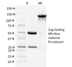 SDS-PAGE - Anti-COX2 Antibody [COX2/1941] (A249771) - Antibodies.com