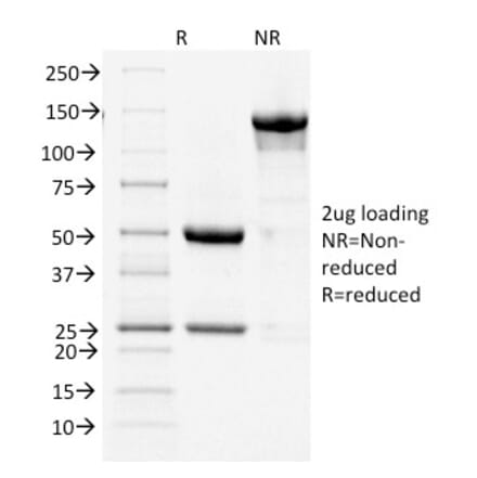 SDS-PAGE - Anti-COX2 Antibody [COX2/1941] (A249771) - Antibodies.com