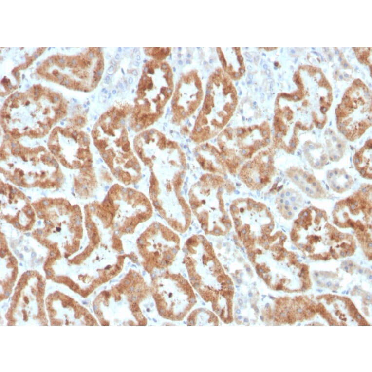 Immunohistochemistry - Anti-COX2 Antibody [COX2/3320R] (A249774) - Antibodies.com