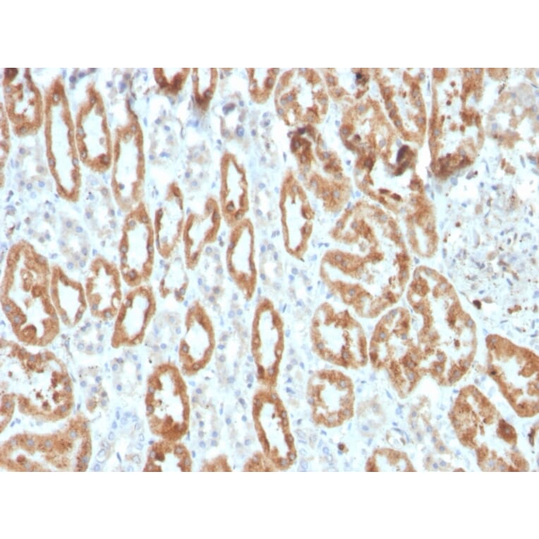 Immunohistochemistry - Anti-COX2 Antibody [COX2/3320R] (A249773) - Antibodies.com