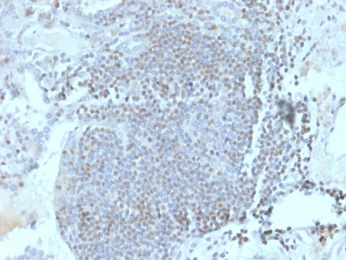 Immunohistochemical analysis of formalin-fixed, paraffin-embedded human lymph node using Anti-HOMEZ Antibody [PCRP-HOMEZ-1A5].