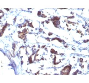 Immunohistochemistry - Anti-ZFYVE28 Antibody [LST2/2426] (A249777) - Antibodies.com