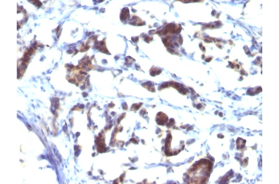 Immunohistochemistry - Anti-ZFYVE28 Antibody [LST2/2426] (A249777) - Antibodies.com