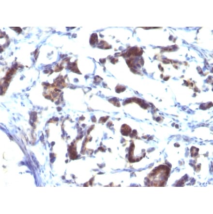 Immunohistochemistry - Anti-ZFYVE28 Antibody [LST2/2426] (A249777) - Antibodies.com