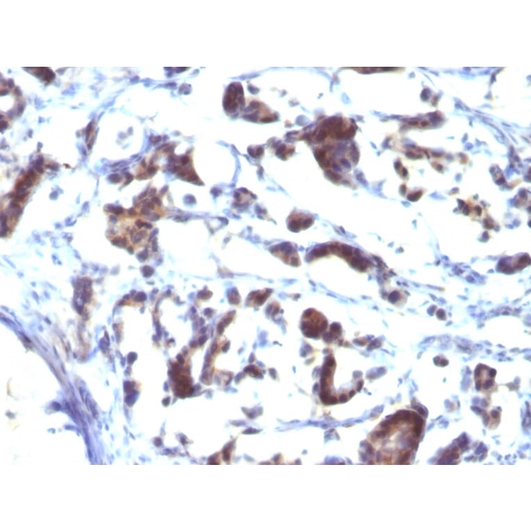 Immunohistochemistry - Anti-ZFYVE28 Antibody [LST2/2426] (A249777) - Antibodies.com