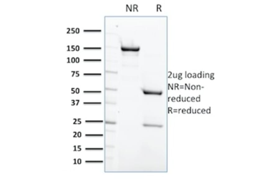 SDS-PAGE - Anti-SHP1 Antibody [CPTC-PTPN6-2] (A249777) - Antibodies.com