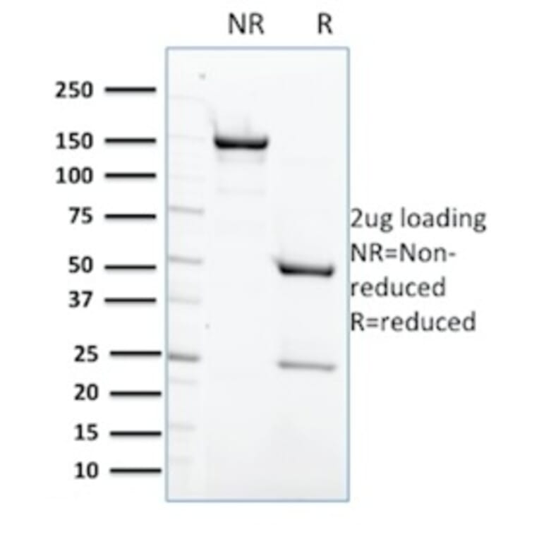 SDS-PAGE - Anti-SHP1 Antibody [CPTC-PTPN6-2] (A249777) - Antibodies.com