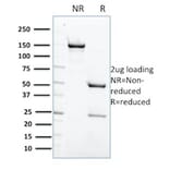 SDS-PAGE - Anti-SHP1 Antibody [CPTC-PTPN6-2] (A249777) - Antibodies.com