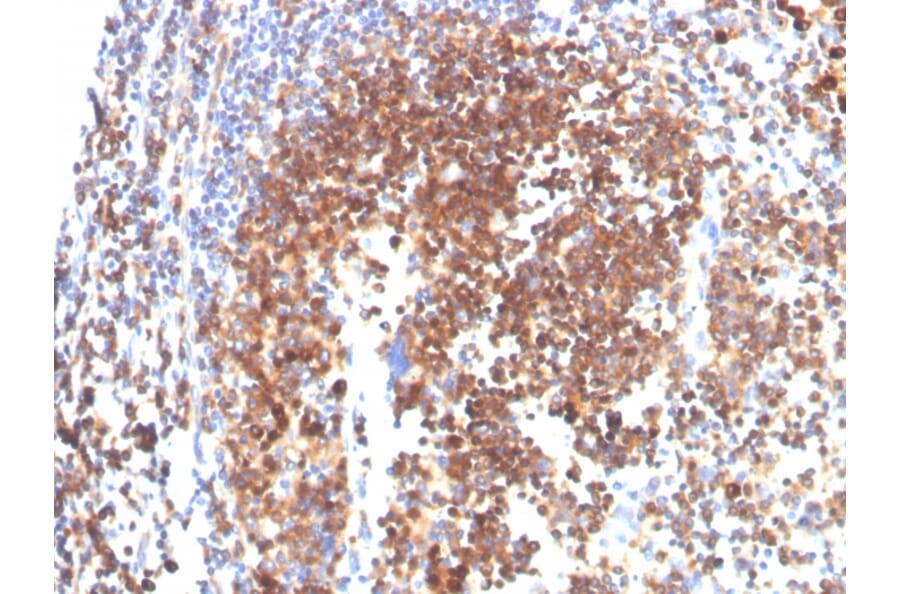 IHC - Anti-SLAMF7 Antibody [SLAMF7/3649] (A249779)