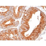 Immunohistochemistry - Anti-SLAMF7 Antibody [SLAMF7/3649] (A249778) - Antibodies.com