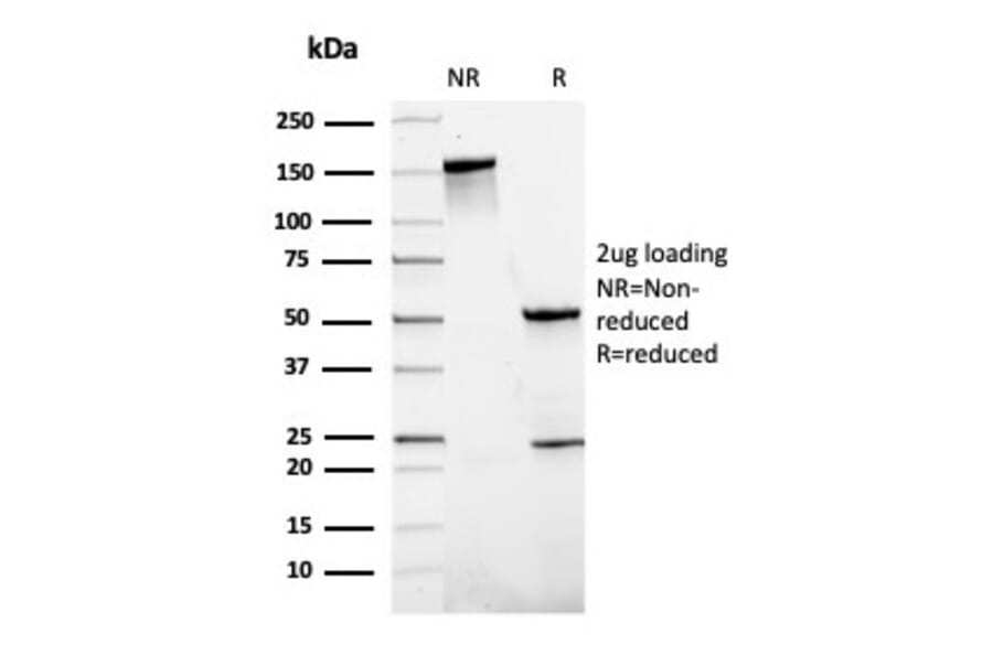 SDS-PAGE - Anti-SLAMF7 Antibody [SLAMF7/3649] (A249779) - Antibodies.com