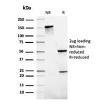SDS-PAGE - Anti-SLAMF7 Antibody [SLAMF7/3649] (A249779) - Antibodies.com
