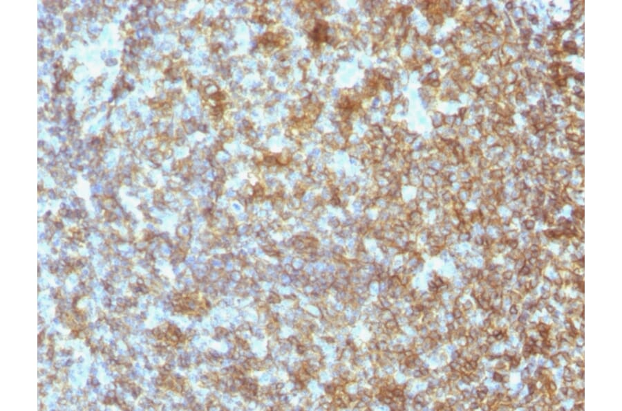 Immunohistochemistry - Anti-CD45 Antibody [SPM496] (A252983) - Antibodies.com