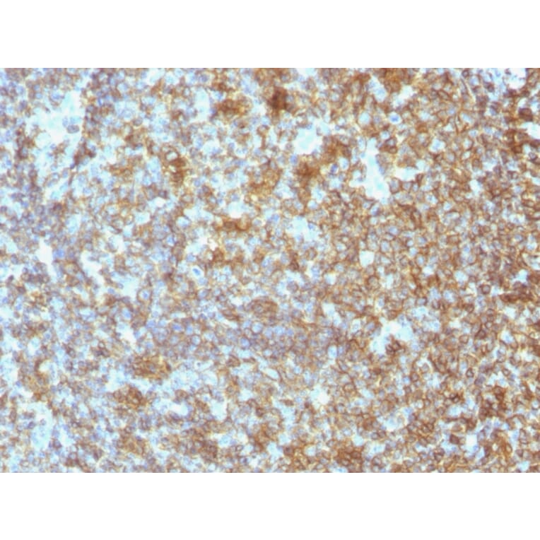 Immunohistochemistry - Anti-CD45 Antibody [SPM496] (A252983) - Antibodies.com