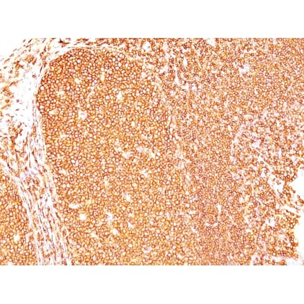 Immunohistochemistry - Anti-CD45 Antibody [Bra55] (A249782) - Antibodies.com