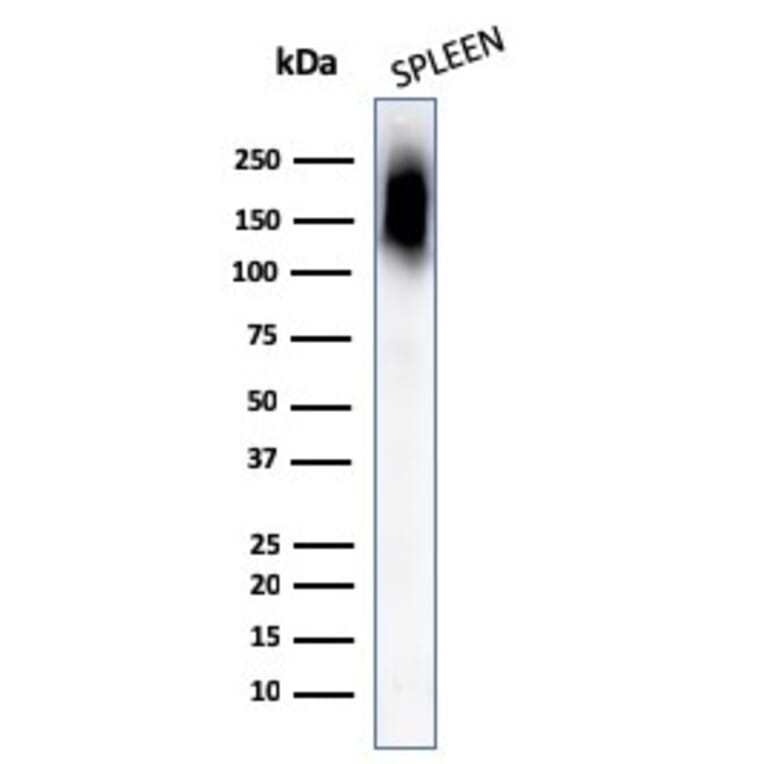 Western Blot - Anti-CD45RB Antibody [PTPRC/1132] (A249787) - Antibodies.com