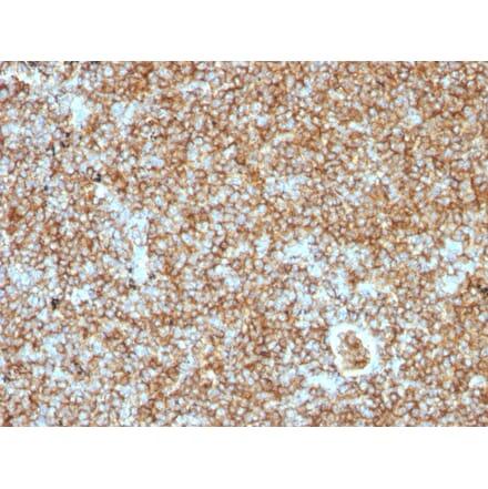 Immunohistochemistry - Anti-CD45RB Antibody [PTPRC/1147] (A249787) - Antibodies.com