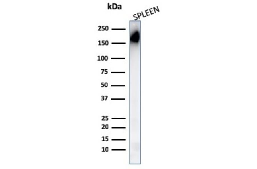Western Blot - Anti-CD45RA Antibody [PTPRC/1148] (A249789) - Antibodies.com
