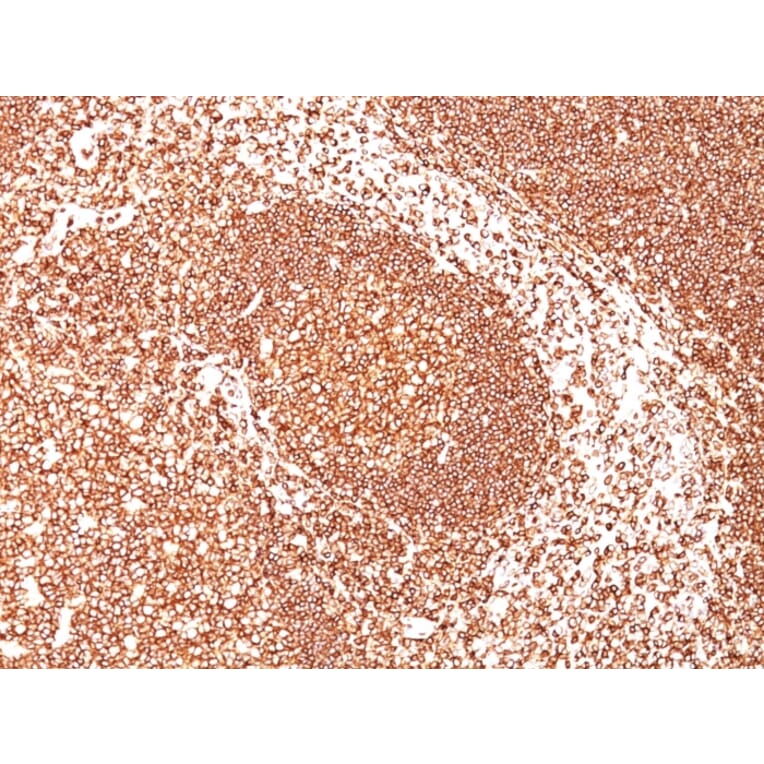 Immunohistochemistry - Anti-CD45 Antibody [PTPRC/1461] (A249794) - Antibodies.com