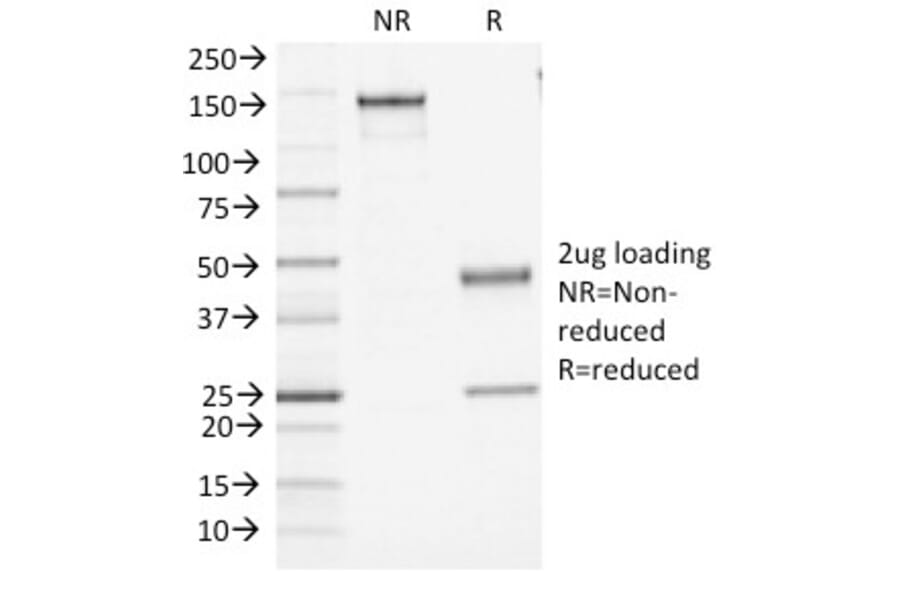 SDS-PAGE - Anti-CD45 Antibody [PTPRC/1461] (A249794) - Antibodies.com