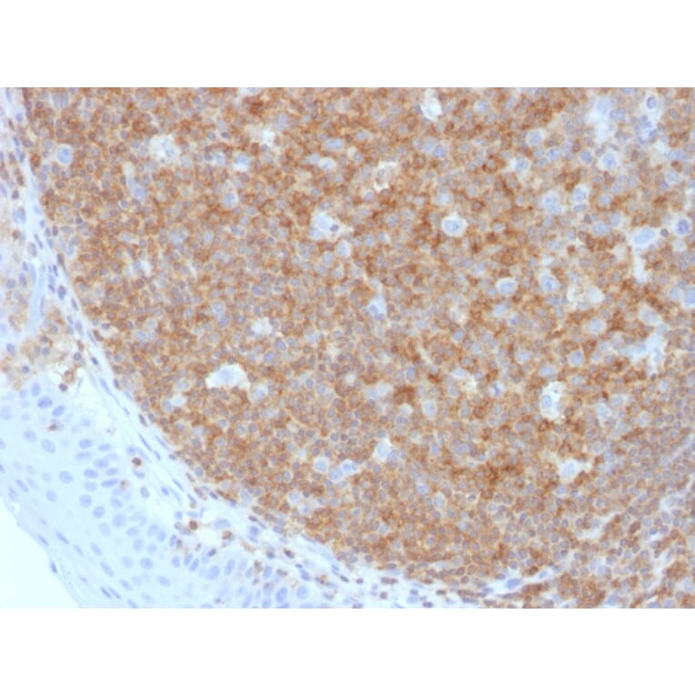 Immunohistochemistry - Anti-CD45 Antibody [F10-89-4] (A249795) - Antibodies.com