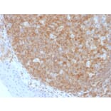 Immunohistochemistry - Anti-CD45 Antibody [F10-89-4] (A249795) - Antibodies.com