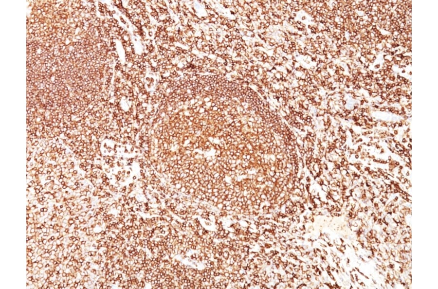 Immunohistochemistry - Anti-CD45 Antibody [F10-89-4] (A249795) - Antibodies.com