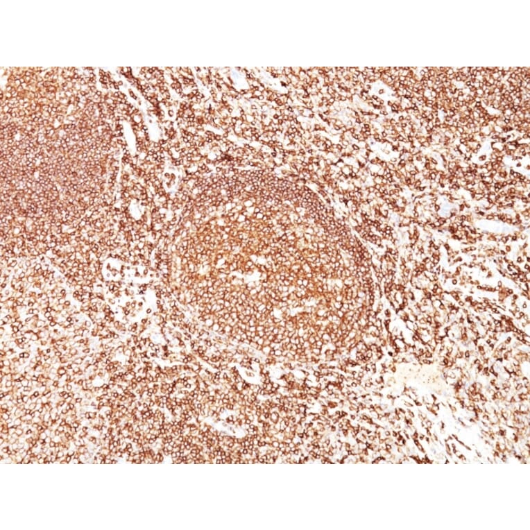 Immunohistochemistry - Anti-CD45 Antibody [F10-89-4] (A249795) - Antibodies.com