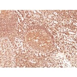 Immunohistochemistry - Anti-CD45 Antibody [F10-89-4] (A249795) - Antibodies.com