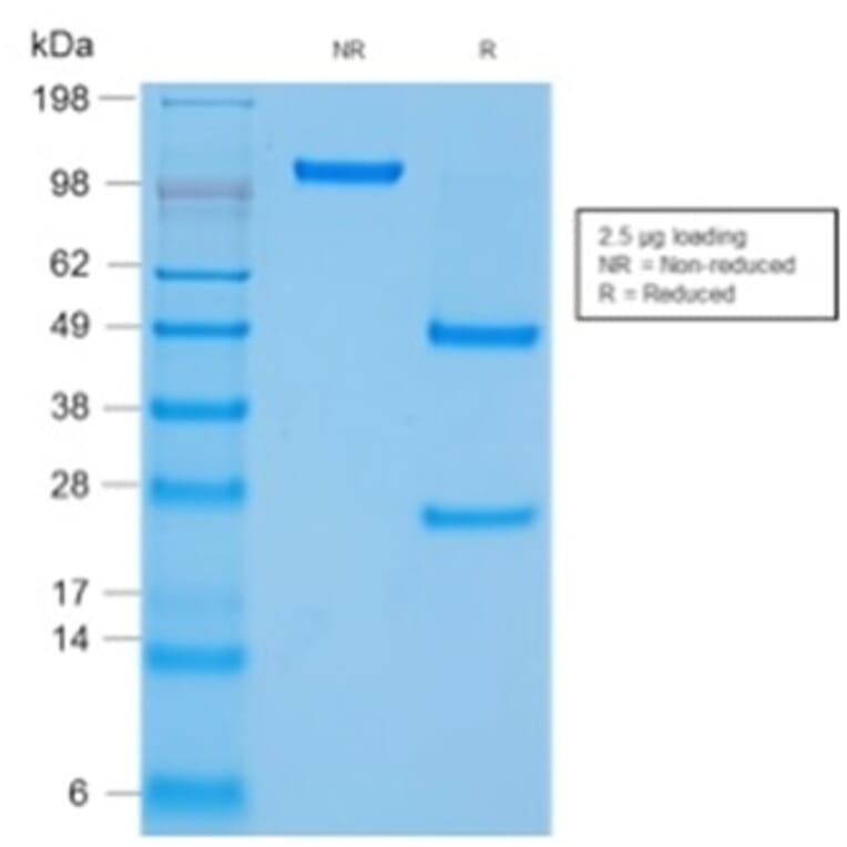 SDS-PAGE - Anti-CD45 Antibody [rPTPRC/1460] (A249798) - Antibodies.com