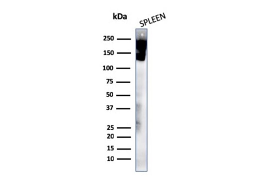 Western Blot - Anti-CD45 Antibody [rPTPRC/1460] (A249798) - Antibodies.com