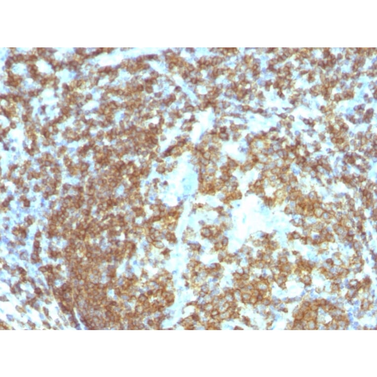 Immunohistochemistry - Anti-CD45RA Antibody [158-4D3] (A249799) - Antibodies.com