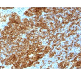 Immunohistochemistry - Anti-CD45RA Antibody [SPM568] (A249800) - Antibodies.com