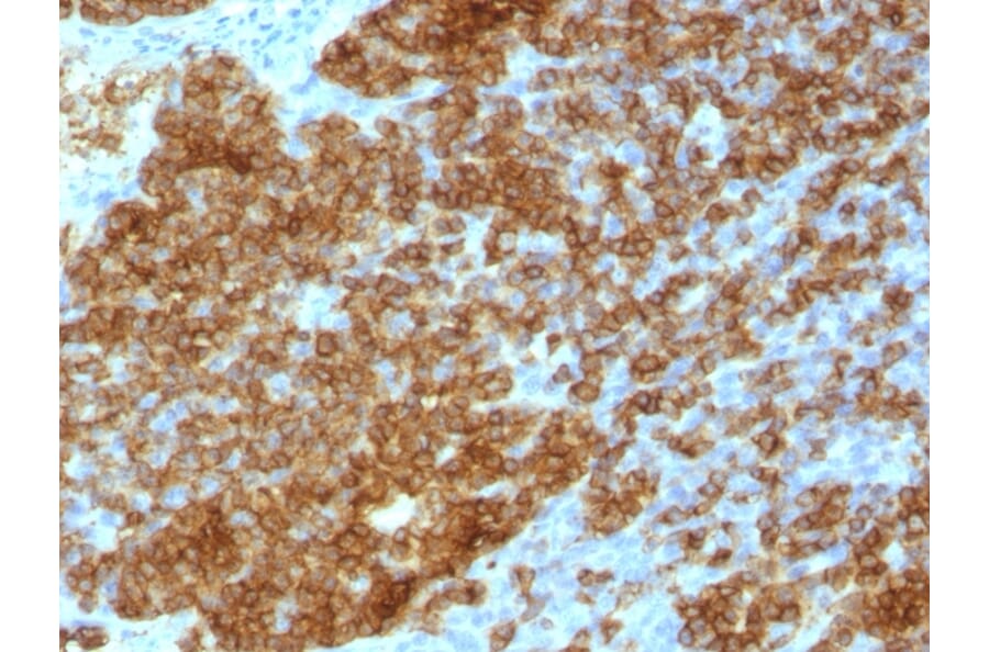 Immunohistochemistry - Anti-CD45RA Antibody [SPM568] (A249800) - Antibodies.com