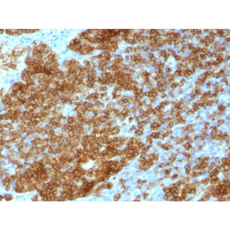 Immunohistochemistry - Anti-CD45RA Antibody [SPM568] (A249800) - Antibodies.com