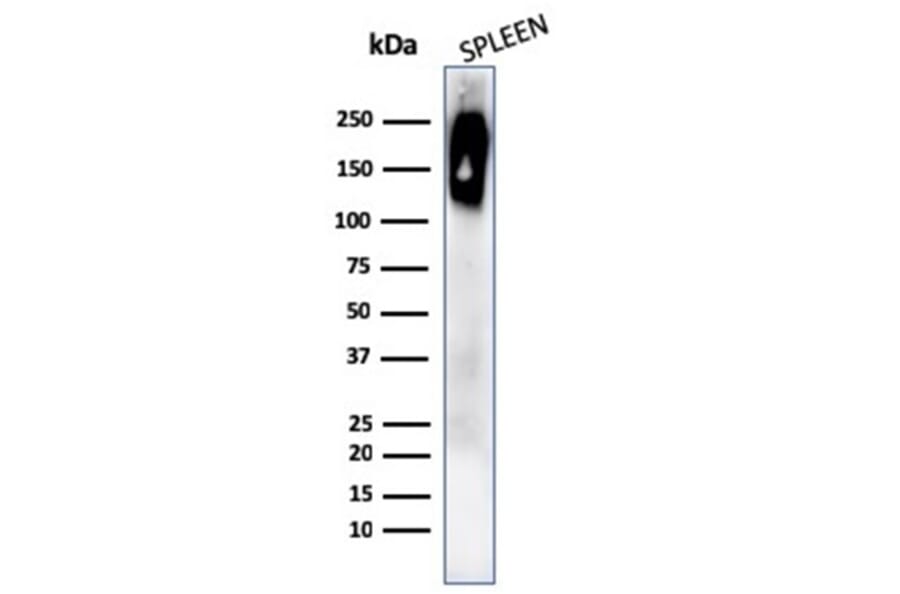 Western Blot - Anti-CD45RB Antibody [rPTPRC/1132] (A249801) - Antibodies.com