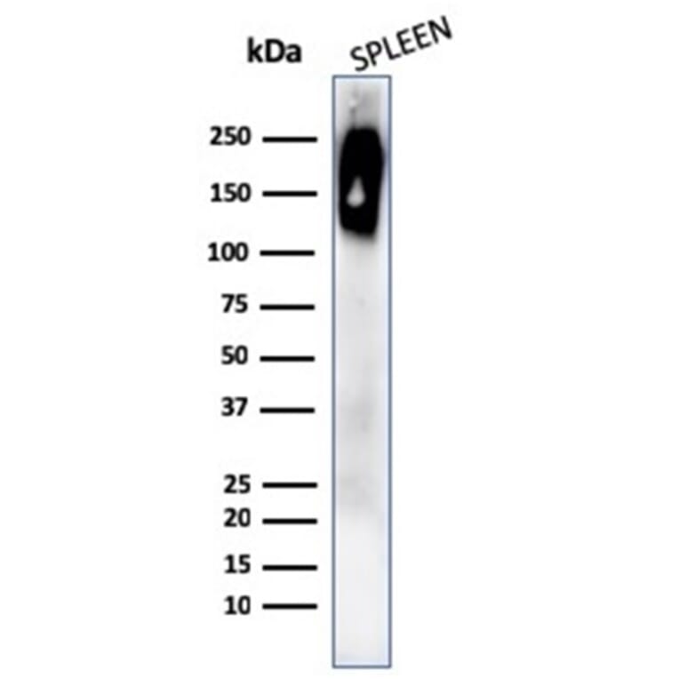 Western Blot - Anti-CD45RB Antibody [rPTPRC/1132] (A249801) - Antibodies.com