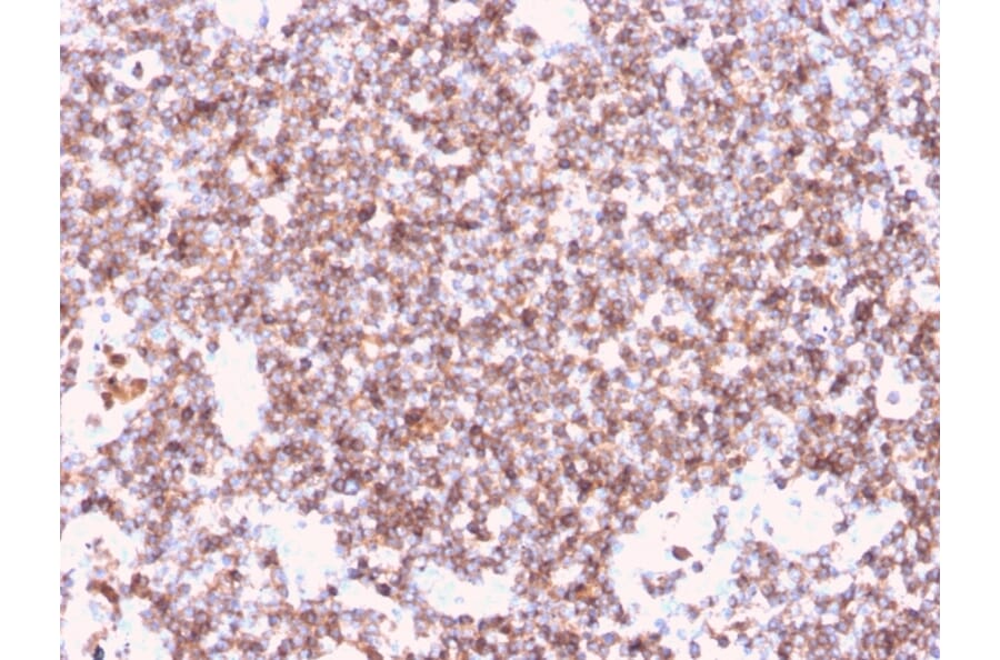 Immunohistochemistry - Anti-CD45 Antibody [rPTPRC/1461] (A249802) - Antibodies.com