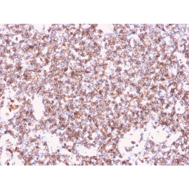 Immunohistochemistry - Anti-CD45 Antibody [rPTPRC/1461] (A249802) - Antibodies.com