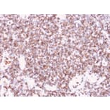 Immunohistochemistry - Anti-CD45 Antibody [rPTPRC/1461] (A249802) - Antibodies.com