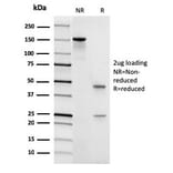 SDS-PAGE - Anti-CD45 Antibody [rPTPRC/1461] (A249803) - Antibodies.com