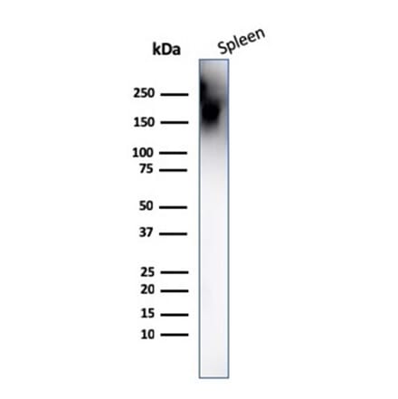 Western Blot - Anti-CD45 Antibody [PTPRC/1666] (A249804) - Antibodies.com