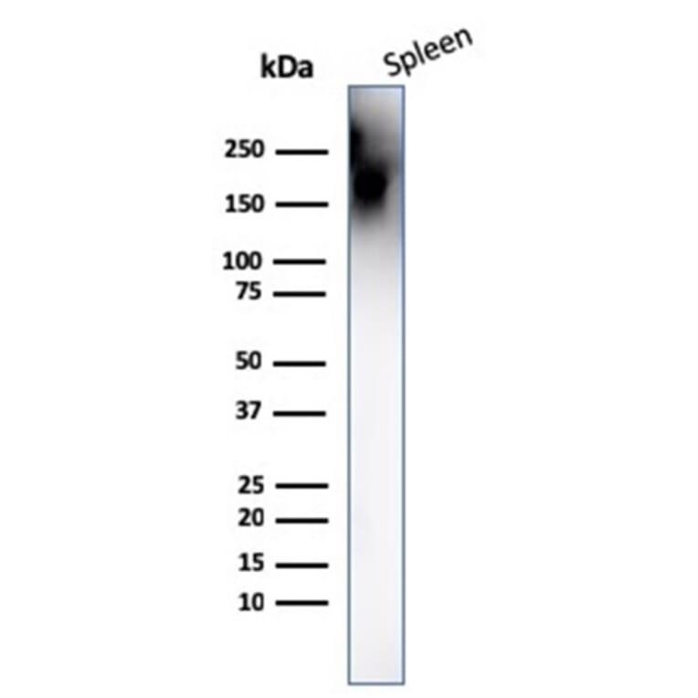 Western Blot - Anti-CD45 Antibody [PTPRC/1666] (A249804) - Antibodies.com