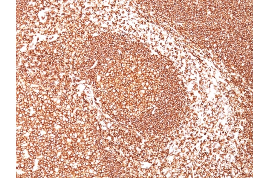 Immunohistochemistry - Anti-CD45 Antibody [2B11] (A249804) - Antibodies.com