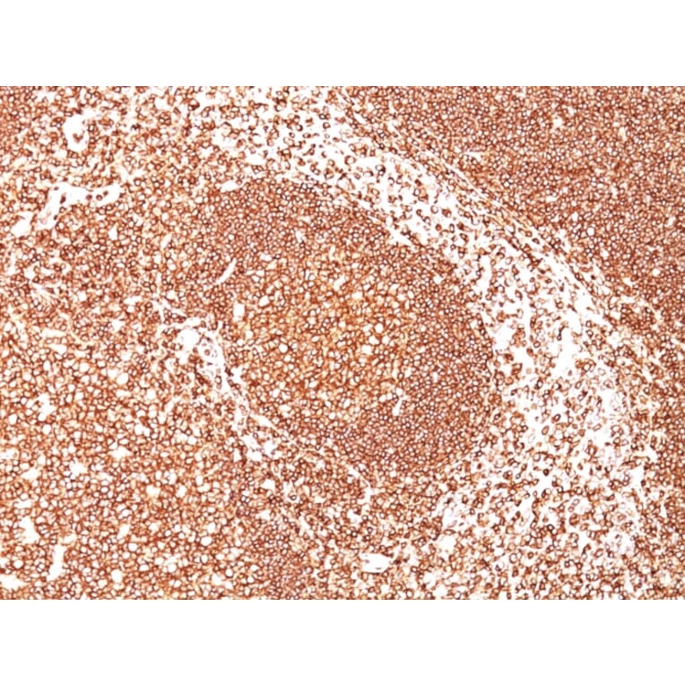 Immunohistochemistry - Anti-CD45 Antibody [2B11] (A249804) - Antibodies.com